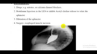 L66 Physiology  Achalasia [upl. by Lopez439]