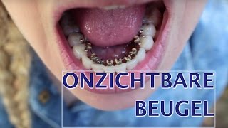 Onzichtbare beugel strakker zetten  FURROWNL [upl. by Yeliak]