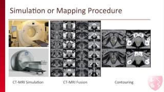 Stanford Radiation Oncologist Explains Radiation Therapy Treatment for Prostate Cancer [upl. by Merchant176]