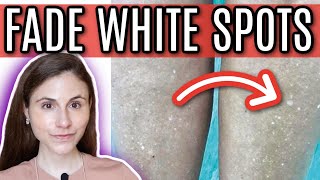 How to FADE WHITE SPOTS from SUN DAMAGE  Dr Dray [upl. by Burgener]