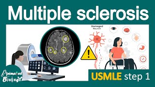 Multiple Sclerosis  Pathology Immunology  diagnosis and treatment of MS  USMLE step 1 [upl. by Crean]