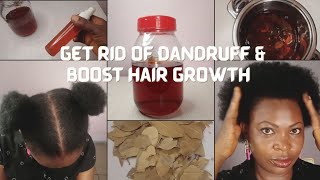 HOW TO GET RID OF DANDRUFF AND ACHIEVE MASSIVE HAIR GROWTH WITH BAYLEAF  BAYLEAF TEA [upl. by Woodsum80]