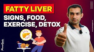 Fatty Liver Is It Safe To Workout [upl. by Willow186]