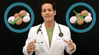 Is Eating Eggs Healthy DOCTOR RESPONDS [upl. by Samal]