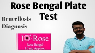 Rose Bengal Plate TestBrucellosis [upl. by Yellac79]