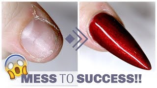 HOW TO FIX A SHORT BROKEN DAMAGED NAIL  GEL AND SILK [upl. by Ahseital591]