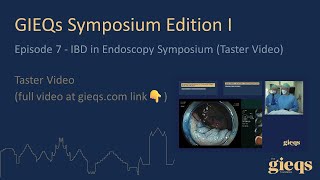 Episode 7  IBD in Endoscopy Symposium Taster Video [upl. by Ridinger308]