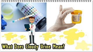 Cloudy Urine  Meaning and Causes of Turbid Pee [upl. by Thorrlow662]