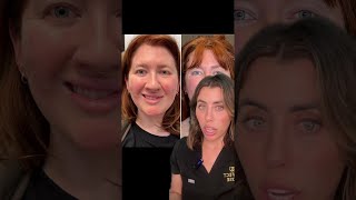 ONE of the Best Botox Transformations EVER botox botoxtreatment skincare [upl. by Annoid]