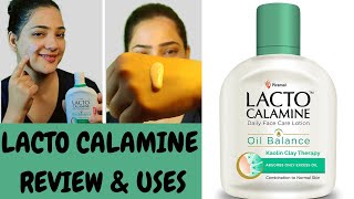 Lacto Calamine Face Lotion Skin Benefitsहिन्दी मैं Calamine lotion Remove Acne Pimples Dark spots [upl. by Andria]