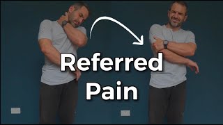 Referred Neck Pain [upl. by Adai]