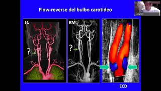 Ultrasound Week School  ECOSU101 lezione 19 [upl. by Anauqat697]