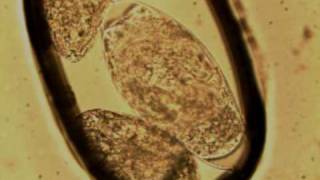 Schistosoma haematobium Miracidium Swimming Inside Egg [upl. by Litnahc143]