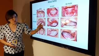 OICP 01 Relación de Mucositis Oral citocinas y estado nutricional en cáncer de cabeza y cuello [upl. by Yrehc]