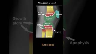 Bone Anatomy knee example 1 Musculoskeletal Xray  General principles radiologychannel007 [upl. by Htbazile]