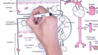 Vasculitis Pathophysiology Overview [upl. by Christianna]