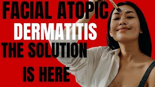 Atopic Dermatitis  Dermatitis Treatment  Atopic Dermatitis Treatments  Discover The Solution Now [upl. by Ehrenberg]