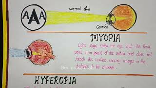 Diagram of eyemyopia hyperopia diagram eyes science [upl. by Laehcar]