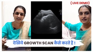 ANC क्या होता हैं  What is ANC Profile Test and How its Done in Pregnancy [upl. by Lledra168]