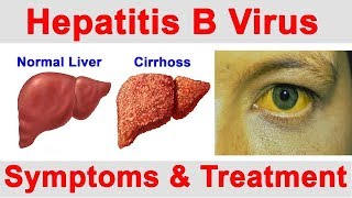 ஹெப்படைட்டிஸ் பி வைரஸ் சிகிச்சை Hepatitis B detail in tamil [upl. by Trescha]