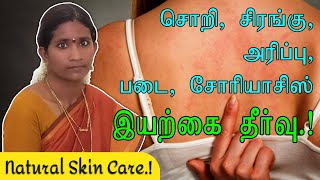 எல்லா தோல் நோய்களுக்கும் சொறி சிரங்கு இது தான் தீர்வு  home remedies for skin diseases in Tamil [upl. by Belva]