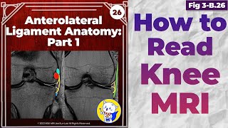 Fig 3B26 Anterolateral Ligament Anatomy [upl. by Lothair]