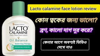 Lacto calamine face lotion reviewউপকারিতাব্যবহার lacto calamine face lotion review in Bengali [upl. by Eyanaj658]