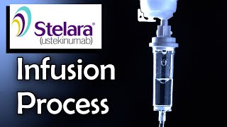 Stelara Infusion Process Ulcerative Colitis Treatment [upl. by Gadmon438]