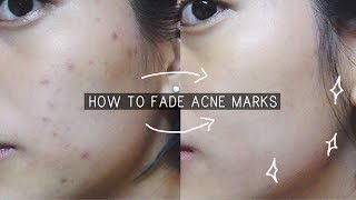 FADE ACNE SCARS IN 1 WEEK  klairs freshly juiced vitamin drop review [upl. by Vod]