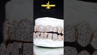 CUSTOM VVS CLARITY DIAMOND GRILLZ HAND SET NATURAL DIAMONDS diamond jewelry grillz gold [upl. by Artur]