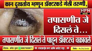 कान दुखतोय म्हणून डॉक्टरकडे गेली तरुणीतपासणीत जे दिसलं ते  Viral Video  Hpn Marathi News [upl. by Joachim971]