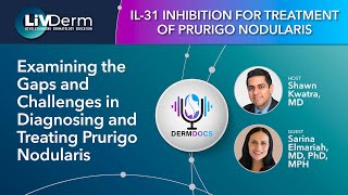 Examining the Gaps and Challenges in Diagnosing and Treating Prurigo Nodularis  Episode 1 [upl. by Lilas]