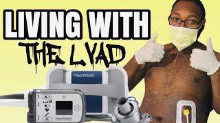 Living With The Lvad THE TRUTH [upl. by Hsotnas]