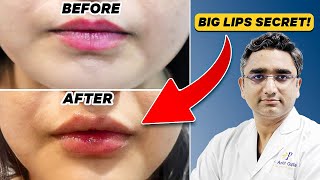 Bigger Better Beautiful Lips  Lip Transformation [upl. by Idnaj]