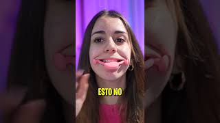 ¡Sonrisa de Joker beauty tips sonrisa [upl. by Hett]