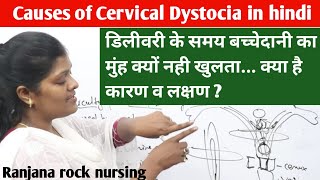 Cervical dystocia  causes symptoms amp management बच्चेदानी का मुँह क्यों नहीं खुलता डिलीवरी के समय [upl. by Ackler]