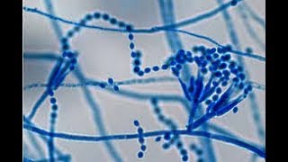 Paecilomyces colony morphology on CMA and LPCB tease mount Microscopy [upl. by Yorker953]