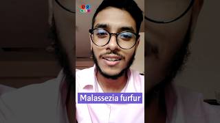 Dandruff  খুশকি  Fungal infection  Malassezia furfur  Dr Med  Sakib Rahaman [upl. by Trahern584]