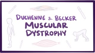 Duchenne amp Becker muscular dystrophy  causes symptoms treatment amp pathology [upl. by Anelra330]