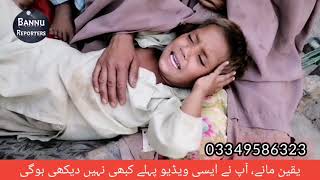 quotImperforate Anusquot Patient in Bannu [upl. by Etteroma]