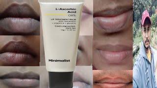 Minimalist L Ascorbic Acid 8 Lip Treatment Balm  Honest Review [upl. by Ivo]