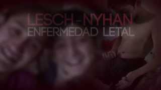 Esta semana LeschNyhan enfermedad letal Testigo Directo HD [upl. by Mendelsohn297]