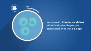 EmbryoScope Patient Information [upl. by Rist]