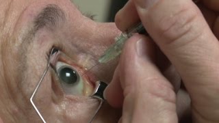 Eyeball injections equal eyepopping profits [upl. by Carri]