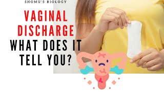 Vaginal discharge types color causes  Vaginal discharge good or bad for your health [upl. by Publus]