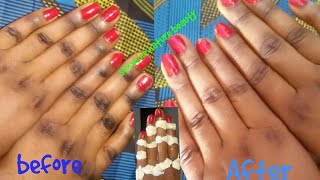 CLEAR DARK KNUCKLES INSTANTLY AT HOME see result Live in video 100 working [upl. by Notniw]