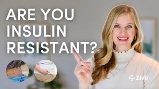 15 Insulin Resistance Signs and Symptoms You NEED To Know [upl. by Rosabella]