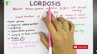 Lordosis  Medical Symptomatology [upl. by Khai]