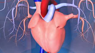 Catheter Ablation What is it and how does it help an irregular heart beat [upl. by Enner771]