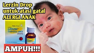 Obat gatal alergi anak lerzin drop [upl. by Atiram355]